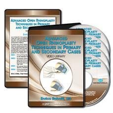 advanced rhinoplasty techniques primary secondary