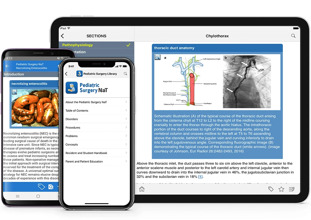 apsa pediatric surgery library
