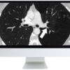 ARRS basic chest imaging
