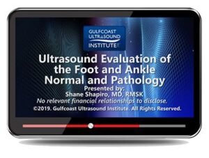 foot ankle ultrasound evaluation
