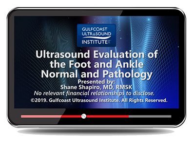 foot ankle ultrasound evaluation