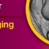 knee imaging essentials webcast