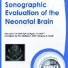 neonatal brain ultrasound evaluation