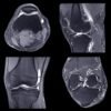 NYU Langone musculoskeletal imaging