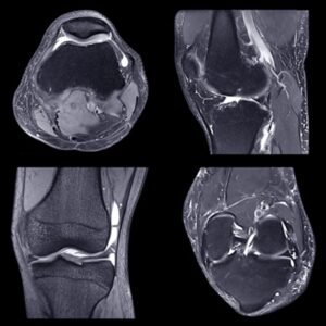 NYU Langone musculoskeletal imaging
