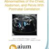 prenatal ultrasound chest abnormalities