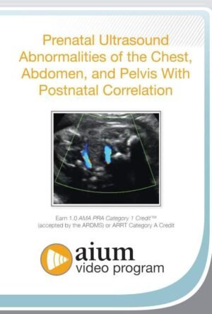 prenatal ultrasound chest abnormalities