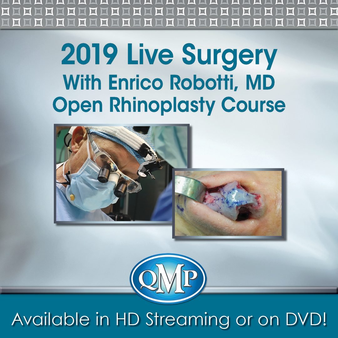 Robotti open rhinoplasty 2019