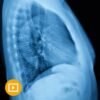 UCSF thoracic imaging course