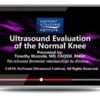 ultrasound evaluation normal knee