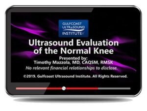 ultrasound evaluation normal knee
