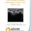 upper limb MSK pathologies