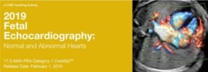 Echocardiography Normal and Abnormal Hearts 2019