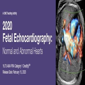 Fetal Echocardiography Normal and Abnormal