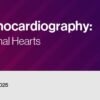 Echocardiography Normal and Abnormal Hearts 2022