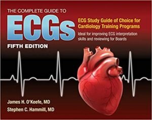 Guide Ecgs Study Guide to Improve