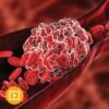 Thrombosis and Thromboembolism 2022