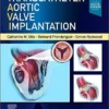 Transcatheter Aortic Valve Implantation Digital Book