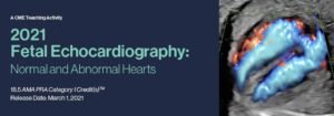 Echocardiography Normal and Abnormal Hearts 2021