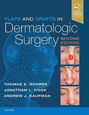 Flaps and Grafts in Dermatologic Surgery Guide