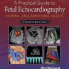Fetal Echocardiography Guide