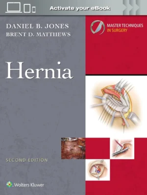 Hernia Surgery Textbook, 2th Edition