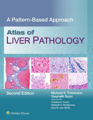 Atlas Of Liver Textbook, 2th Edition