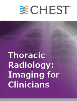 Thoracic Radiology Imaging for Clinicians 2021 Guide