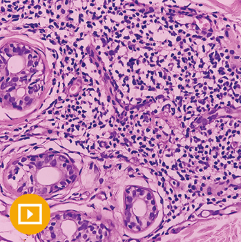 Oakstone Dermatopathology Course Guide 2025