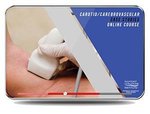 GCUS Carotid Cerebrovascular Case Studies 2022