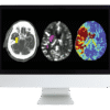 Code Stroke Radiology Course | ARRS 2022