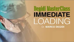 Degidi Masterclass Immediate Loading