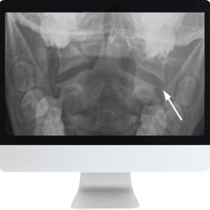 Neuroradiology Review Course | ARRS 2018