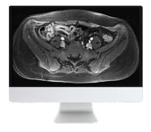 Bowel Imaging Course | ARRS 2019
