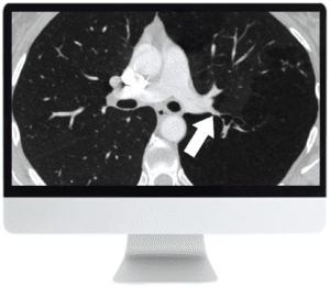 Chest Imaging CME Course | ARRS 2019