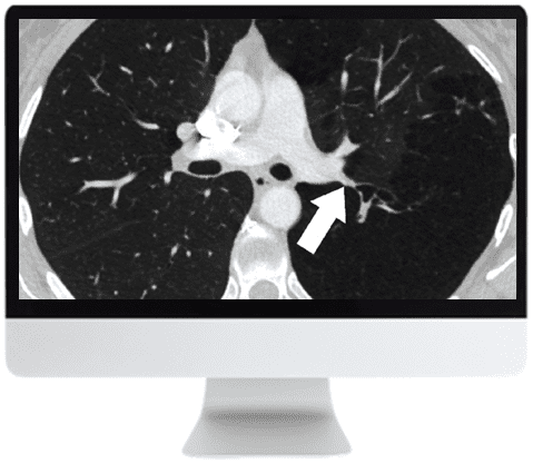 Chest Imaging CME Course | ARRS 2019