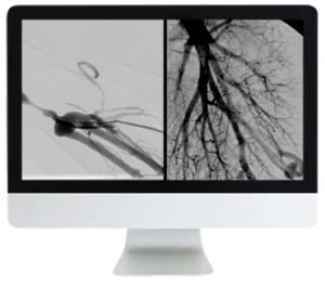 ARRS Case Review of Vascular and Interventional Radiology 2023 (Videos)
