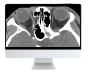 Imaging Victims of Violence CME Course