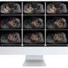 Musculoskeletal Imaging AI CME Course 2021