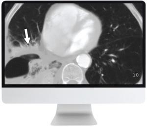 Multispecialty Radiology Case Review | ARRS 2019