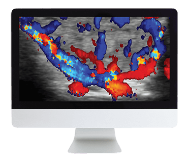 Thyroid Imaging CME Course | ARRS 2019