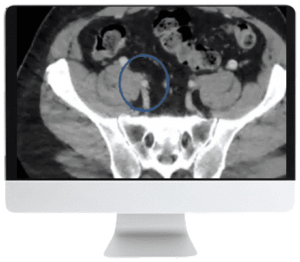 Venous Disease CME Course | ARRS 2021