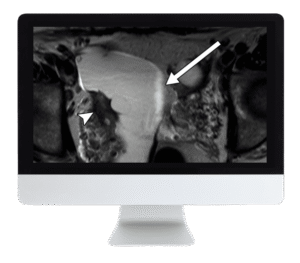 Women's Imaging CME Course | ARRS 2019