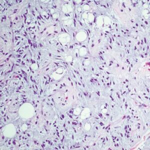 Oakstone Cleveland Clinic Comprehensive and Immersive Soft Tissue Pathology 2025
