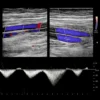 Vascular Ultrasound RPVI Prep Course 2026