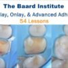 Overlay Onlay and Advanced Adhesion Guide