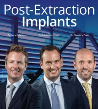 Post Extraction Implants Course