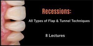 Recessions All Types of Flap and Tunnel Techniques Course