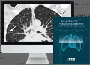 High-Resolution Chest CT Course | ARRS 2024