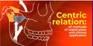 OHI-S Centric Relation All Methods Registration Clinical Course